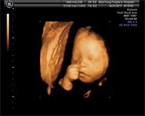 西安代孕网_西安代孕代生孩子_西安卵巢早衰是否能怀孕